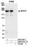 Myosin Heavy Chain 14 antibody, A305-270A, Bethyl Labs, Immunoprecipitation image 