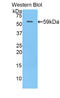 N-Acetyl-Alpha-Glucosaminidase antibody, LS-C300510, Lifespan Biosciences, Western Blot image 