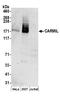 Capping Protein Regulator And Myosin 1 Linker 1 antibody, A304-556A, Bethyl Labs, Western Blot image 