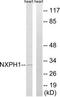 Neurexophilin 1 antibody, TA315409, Origene, Western Blot image 