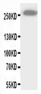 ATP Binding Cassette Subfamily A Member 4 antibody, LS-C313193, Lifespan Biosciences, Western Blot image 
