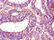 6-phosphofructokinase, muscle type antibody, CSB-PA017822LA01HU, Cusabio, Immunohistochemistry paraffin image 