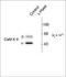 Calcium/Calmodulin Dependent Protein Kinase II Inhibitor 2 antibody, NBP1-50259, Novus Biologicals, Western Blot image 