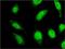 Uncharacterized protein C18orf23 antibody, H00147341-M01, Novus Biologicals, Immunocytochemistry image 