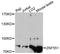 Zinc Finger Protein 551 antibody, LS-C748808, Lifespan Biosciences, Western Blot image 