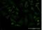 Leucine Rich Repeat Neuronal 1 antibody, H00057633-M11-100ug, Novus Biologicals, Immunofluorescence image 