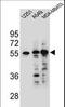 Syncoilin, Intermediate Filament Protein antibody, LS-C161639, Lifespan Biosciences, Western Blot image 