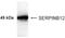 Serpin Family B Member 12 antibody, NB100-93572, Novus Biologicals, Western Blot image 