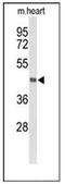 Deleted in bladder cancer protein 1 homolog antibody, AP51190PU-N, Origene, Western Blot image 