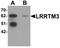 Leucine-rich repeat transmembrane neuronal protein 3 antibody, TA320177, Origene, Western Blot image 