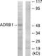 Adrenoceptor Beta 1 antibody, TA313441, Origene, Western Blot image 