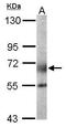 Polypeptide N-Acetylgalactosaminyltransferase 2 antibody, TA308882, Origene, Western Blot image 