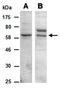 Killer Cell Lectin Like Receptor G1 antibody, orb67026, Biorbyt, Western Blot image 