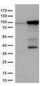 EWS RNA Binding Protein 1 antibody, TA813055S, Origene, Western Blot image 