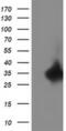 Replication Termination Factor 2 antibody, MA5-25405, Invitrogen Antibodies, Western Blot image 