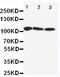 ATPase Sarcoplasmic/Endoplasmic Reticulum Ca2+ Transporting 1 antibody, PA5-78834, Invitrogen Antibodies, Western Blot image 