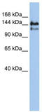 SPT5 Homolog, DSIF Elongation Factor Subunit antibody, TA334735, Origene, Western Blot image 