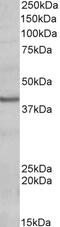HLA class II histocompatibility antigen, DQ alpha 2 chain antibody, 42-669, ProSci, Western Blot image 