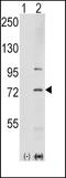 Serine/threonine-protein kinase PAK 1 antibody, PA5-15115, Invitrogen Antibodies, Western Blot image 