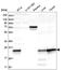 O-6-Methylguanine-DNA Methyltransferase antibody, HPA032136, Atlas Antibodies, Western Blot image 