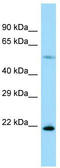 Ribosomal Protein L17 antibody, TA335161, Origene, Western Blot image 