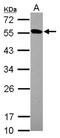 Protein Kinase Domain Containing, Cytoplasmic antibody, NBP2-19960, Novus Biologicals, Western Blot image 