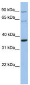 SLAMF6 antibody, TA342075, Origene, Western Blot image 
