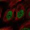 DNA repair protein RAD52 homolog antibody, HPA028957, Atlas Antibodies, Immunocytochemistry image 