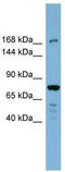 Death-associated protein kinase 1 antibody, TA344411, Origene, Western Blot image 