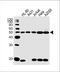 Keratin 28 antibody, A15408, Boster Biological Technology, Western Blot image 