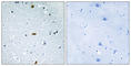 Zinc Finger Homeobox 3 antibody, abx013635, Abbexa, Western Blot image 