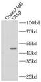 Vasodilator Stimulated Phosphoprotein antibody, FNab09375, FineTest, Immunoprecipitation image 