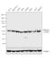 Protein Phosphatase 2 Regulatory Subunit Balpha antibody, MA5-15007, Invitrogen Antibodies, Western Blot image 