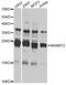 EEF1A Lysine Methyltransferase 1 antibody, STJ29541, St John