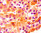 Midkine antibody, A52856-100, Epigentek, Immunohistochemistry paraffin image 