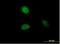 Histone Cluster 1 H1 Family Member A antibody, H00003024-B01P, Novus Biologicals, Immunocytochemistry image 