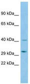 Abhydrolase Domain Containing 14A antibody, TA331955, Origene, Western Blot image 