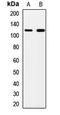 Peptidase, Mitochondrial Processing Alpha Subunit antibody, LS-C667911, Lifespan Biosciences, Western Blot image 