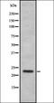 Sin3A Associated Protein 30 antibody, orb337559, Biorbyt, Western Blot image 