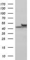Tubulin Beta 2B Class IIb antibody, TA506696S, Origene, Western Blot image 