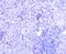 Janus Kinase 2 antibody, A00027Y1007Y1008, Boster Biological Technology, Immunohistochemistry paraffin image 