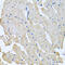 Glycosylphosphatidylinositol Specific Phospholipase D1 antibody, LS-C334829, Lifespan Biosciences, Immunohistochemistry paraffin image 