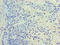 RAB11A, Member RAS Oncogene Family antibody, A56050-100, Epigentek, Immunohistochemistry paraffin image 