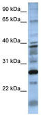 Dolichyldiphosphatase 1 antibody, TA338419, Origene, Western Blot image 