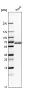 NAD-dependent malic enzyme, mitochondrial antibody, HPA008880, Atlas Antibodies, Western Blot image 