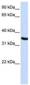 Developmental pluripotency-associated protein 2 antibody, TA340320, Origene, Western Blot image 