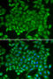 RAB11A, Member RAS Oncogene Family antibody, 14-092, ProSci, Immunofluorescence image 