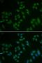 Tumor Protein P63 antibody, LS-C331932, Lifespan Biosciences, Immunofluorescence image 
