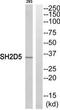 SH2 domain-containing protein 5 antibody, TA316452, Origene, Western Blot image 