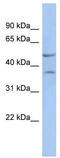 Homeobox protein Nkx-6.1 antibody, TA331124, Origene, Western Blot image 